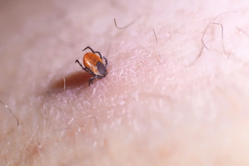Macro. The insect mite only sucked on the human skin. He's still skinny and hasn't drunk a clove.